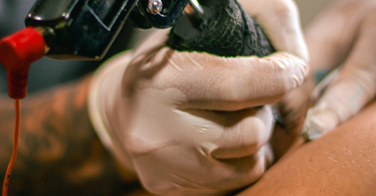 Recognising Allergic Reactions vs. Infection in Tattoos